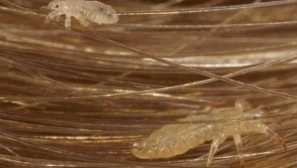 Co se vershi objevují na hlavě