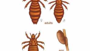 Preventivní opatření pro dětskou pediculózu v mateřských školách, školách a metodách domácího prostředí a prostředky