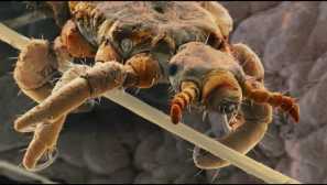 Nude from pediculose: funkce a podmínky použití